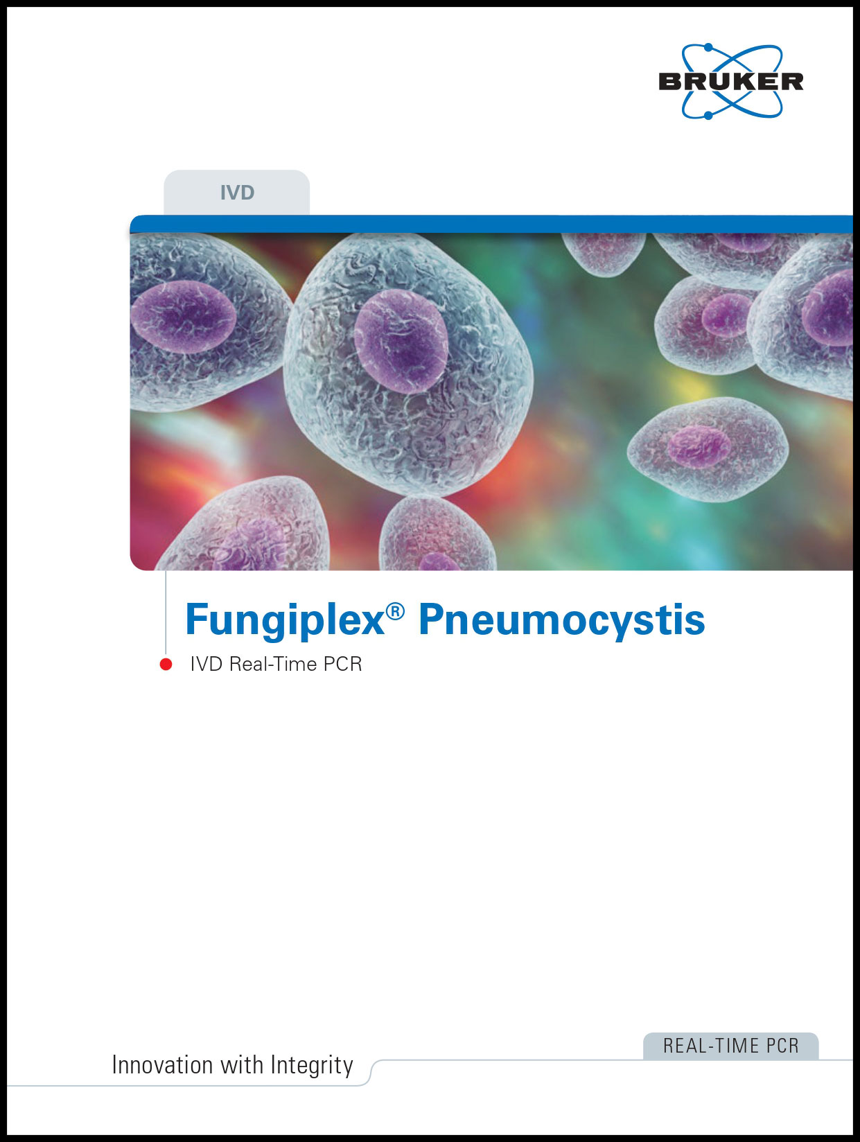Fungiplex® Pneumocystis IVD Real-Time PCR Kit