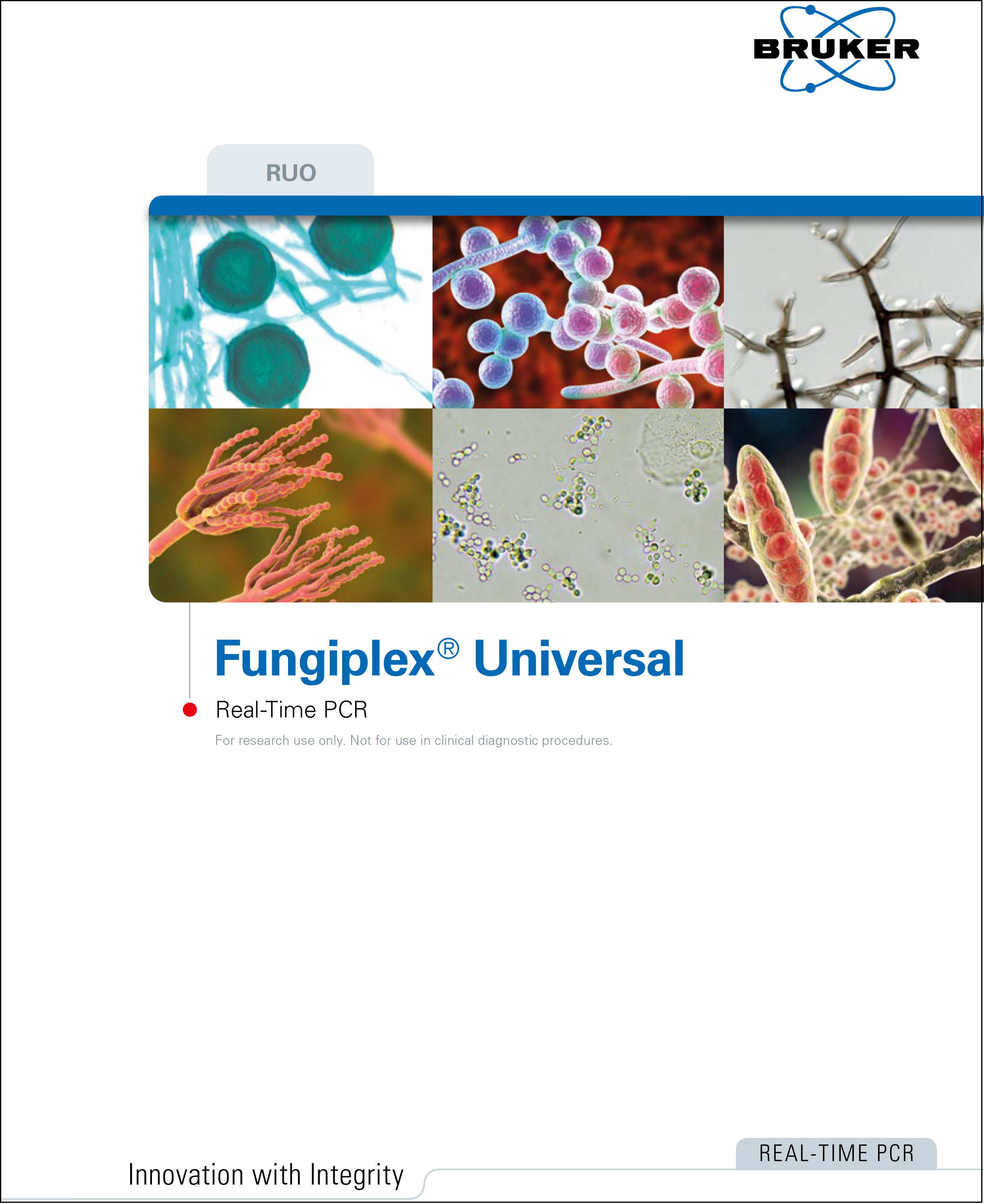 Fungiplex® Universal RUO Real-Time PCR Kit