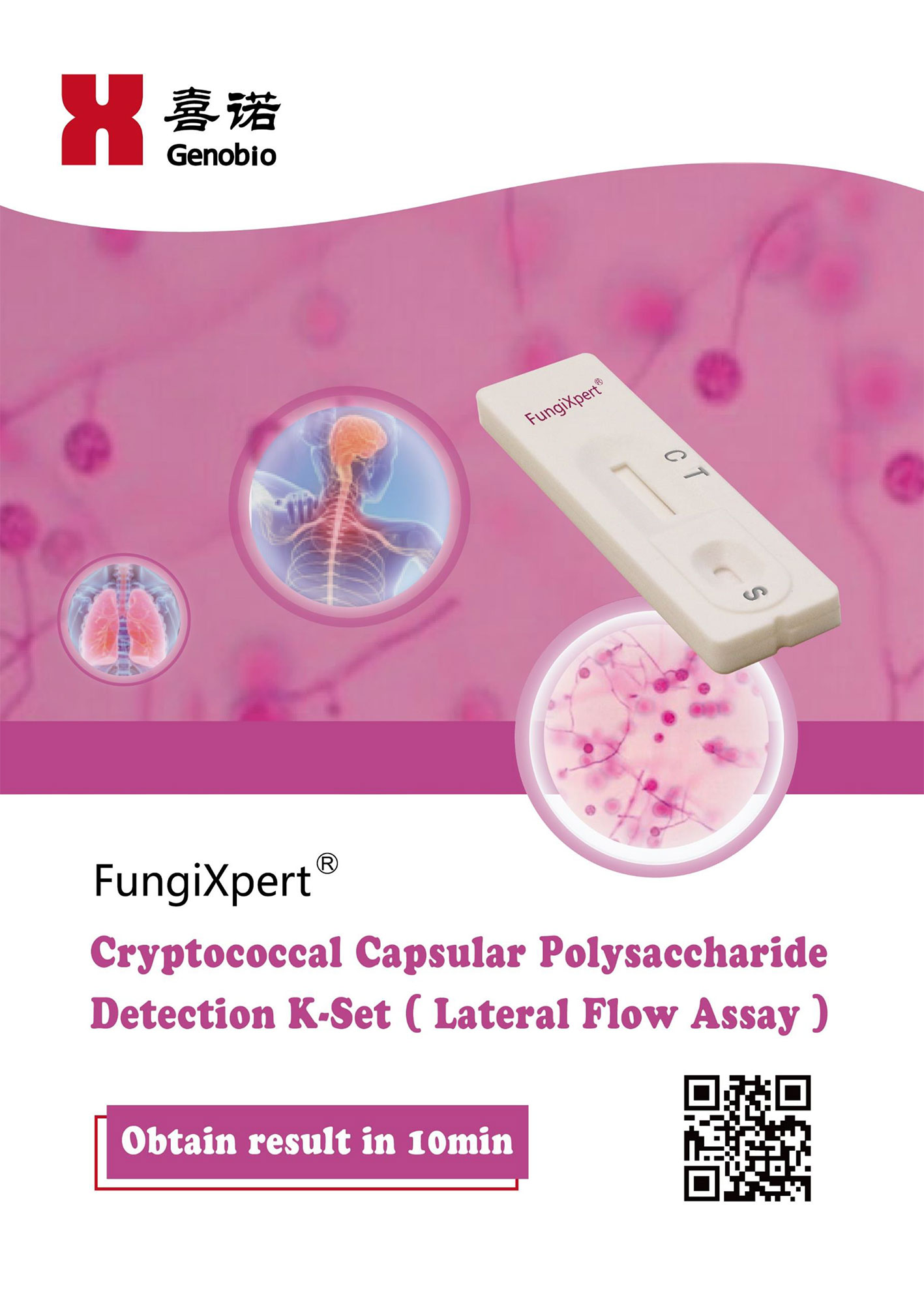 FungiXpert® Cryptococcal Capsular Polysaccharide Detection K-Set (Lateral Flow Assay)